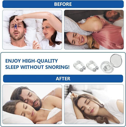 SnoreShield Pro - Premium Anti Snoring Device