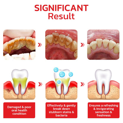 Original™ SP4 Ultra Teeth Whitening Toothpaste (Buy 1 Get 2)